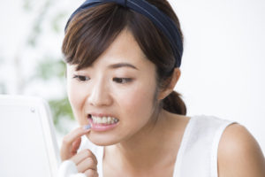 歯茎の腫れを気にする女性