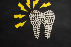 虫歯になりやすい食べ物・なりにくい食べ物、虫歯予防法など紹介【医師監修】