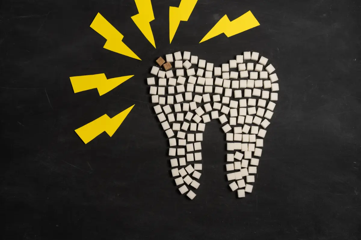 虫歯になりやすい食べ物・なりにくい食べ物、虫歯予防法など紹介【医師監修】